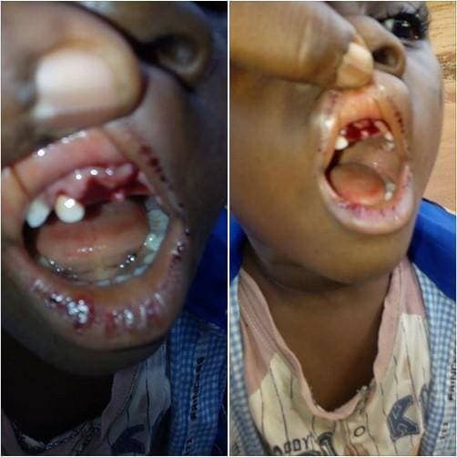 See Photo of What a Teacher Did to a 4-Year Old Pupil